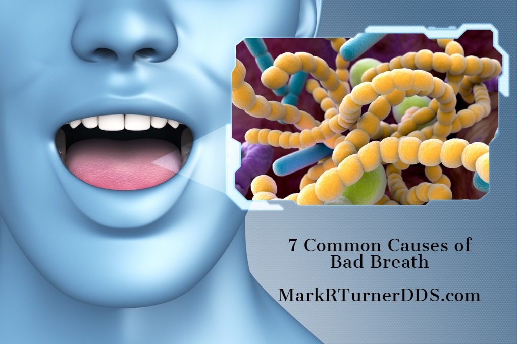 7 Common Causes Of Bad Breath Mark R Turner Dds